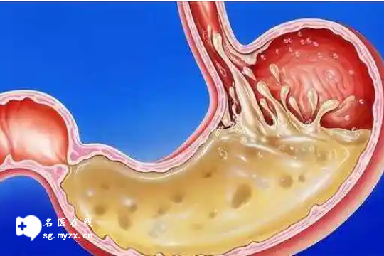 孕妇胃酸该怎么缓解,饭后一杯水是关键,让你告别胃部不适感!